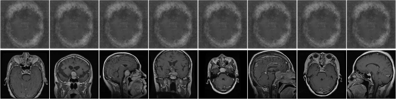 Two rows of eight greyscale panels. The top row is eight outputs from the trained generator: soft blurred grey ovals on dark backgrounds, faintly suggesting a skull outline, with no internal anatomy and no visible lesion, and all eight are indistinguishable from one another. The bottom row is eight real pituitary training scans, sharply detailed and all different: three axial views through the skull base showing eye sockets and sinuses, three sagittal mid-line views showing the corpus callosum and brain stem in profile, and two coronal views, several with a bright lesion at the pituitary fossa.