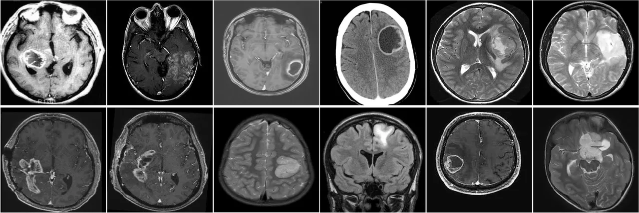 Twelve brain scans in two rows of six, all gliomas the best model classified as having no tumor. Every panel carries a large obvious lesion. They vary widely in appearance: bright grainy scans, dark scans with bright tissue at the skull base, pale flat-background scans, one with a thick solid white skull ring around a smooth grey brain and a large dark cavity, several bright images with pale masses, and one coronal view with a mass in the upper left frontal region. One panel has faint illegible text burned into the bottom edge and another shows a small mouse cursor near the mid-line.